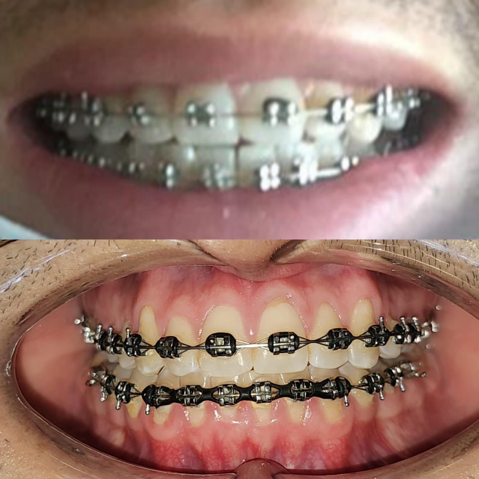 Sonrisa alineada